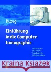 Einführung in Die Computertomographie: Mathematisch-Physikalische Grundlagen Der Bildrekonstruktion Buzug, Thorsten M. 9783642621840 Springer