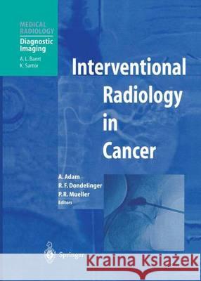 Interventional Radiology in Cancer Andreas Adam Robert F. Dondelinger Peter R. Mueller 9783642622359