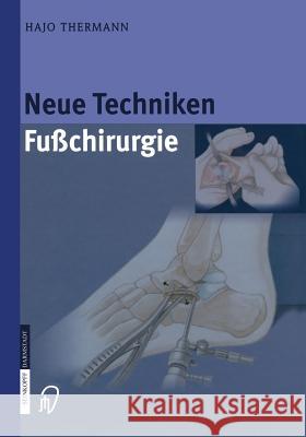 Neue Techniken Fusschirurgie Hajo Thermann 9783642622809 Steinkopff-Verlag Darmstadt