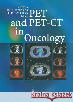 Pet and Pet-CT in Oncology Oehr, Peter 9783642622984 Springer