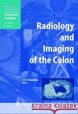 Radiology and Imaging of the Colon Anthony H. Chapman 9783642623141 Springer