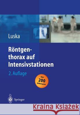 Röntgenthorax auf Intensivstationen Heiner Boetticher, W. Kuckelt, R. Saßen, L. Schwarze, Günter Luska 9783642623271