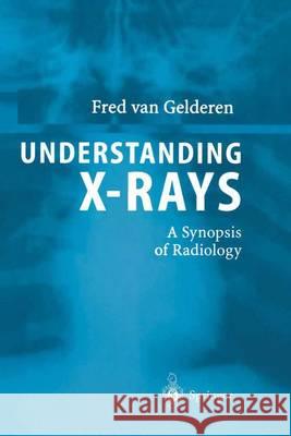 Understanding X-Rays: A Synopsis of Radiology Van Gelderen, Fred 9783642623677