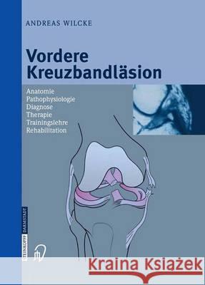 Vordere Kreuzbandläsion: Anatomie Pathophysiologie Diagnose Therapie Trainingslehre Rehabilitation Wilcke, Andreas 9783642623790 Steinkopff-Verlag Darmstadt