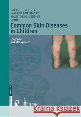 Common Skin Diseases in Children: Diagnosis and Management Abeck, Dietrich 9783642624179 Steinkopff-Verlag Darmstadt