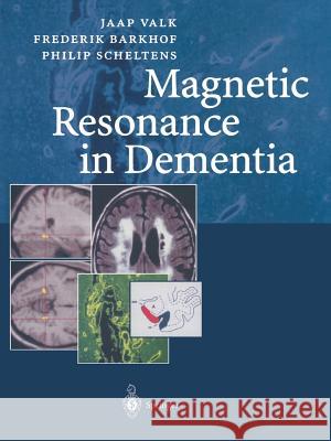 Magnetic Resonance in Dementia Frederik Barkhof Jaap Valk Nick C. Fox 9783642625978