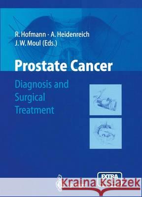 Prostate Cancer: Diagnosis and Surgical Treatment Hofmann, R. 9783642626432 Springer