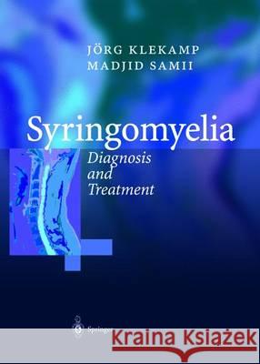 Syringomyelia: Diagnosis and Treatment Klekamp, Jörg 9783642626517 Springer