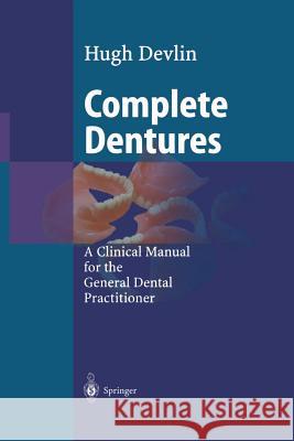 Complete Dentures Hugh Devlin 9783642626654 Springer