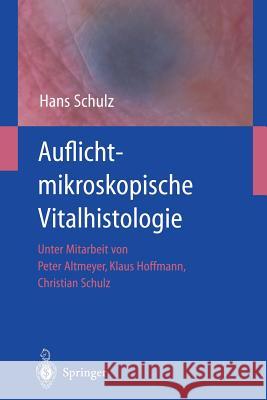 Auflichtmikroskopische Vitalhistologie: Dermatologischer Leitfaden Schulz, Hans 9783642626692 Springer