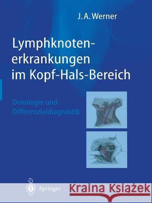 Lymphknotenerkrankungen Im Kopf-Hals-Bereich: Onkologie Und Differenzialdiagnostik Werner, Jochen A. 9783642627606