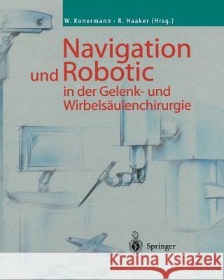 Navigation Und Robotic in Der Gelenk- Und Wirbelsäulenchirurgie Konermann, Werner 9783642627996 Springer
