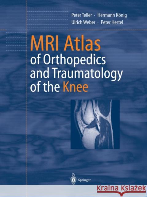 MRI Atlas of Orthopedics and Traumatology of the Knee Peter Teller Hermann Konig Ulrich Weber 9783642628856