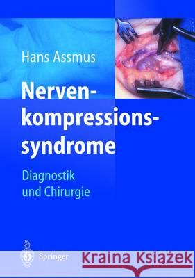 Nerven-Kompressions-Syndrome: Diagnostik Und Chirurgie Antoniadis, G. 9783642629037