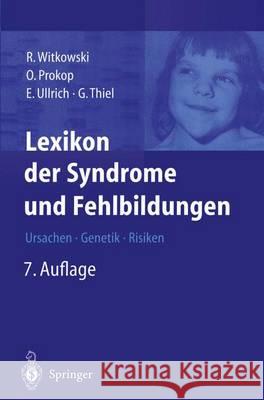 Lexikon Der Syndrome Und Fehlbildungen: Ursachen, Genetik Und Risiken Witkowski, Regine 9783642629273 Springer