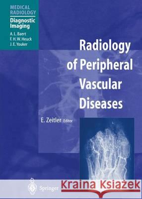 Radiology of Peripheral Vascular Diseases E. Zeitler A. L. Baert 9783642629365 Springer