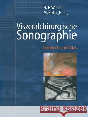 Viszeralchirurgische Sonographie: Lehrbuch Und Atlas Weiser, H. -F 9783642629587 Springer