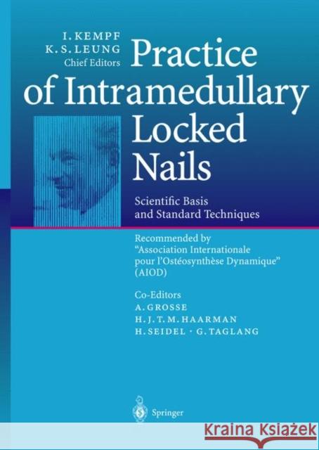 Practice of Intramedullary Locked Nails: Scientific Basis and Standard Techniques Recommended “Association Internationale pour I’Ostéosynthèse Dynamique” (AIOD) I. Kempf, K.S. Leung, A. Grosse, H.J.T.M. Haarman, H. Seidel, G. Taglang 9783642629617 Springer-Verlag Berlin and Heidelberg GmbH & 