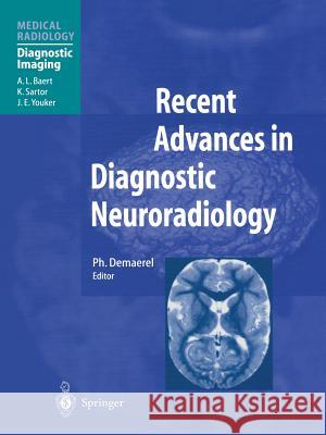 Recent Advances in Diagnostic Neuroradiology Ph. Demaerel A. L. Baert 9783642630033 Springer