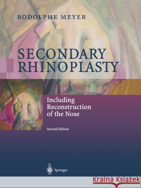 Secondary Rhinoplasty: Including Reconstruction of the Nose Meyer, Rodolphe 9783642630132 Springer