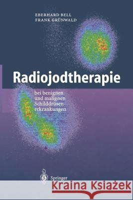 Radiojodtherapie: Bei Benignen Und Malignen Schilddrüsenerkrankungen Bell, Eberhard 9783642630149