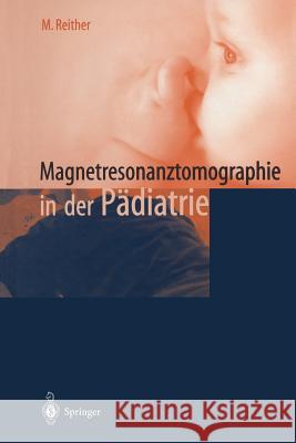 Magnetresonanztomographie in Der Pädiatrie Reither, M. 9783642630453 Springer