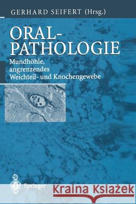 Oralpathologie: Mundhöhle, Angrenzendes Weichteil- Und Knochengewebe Seifert, Gerhard 9783642630538
