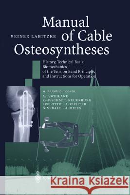 Manual of Cable Osteosyntheses: History, Technical Basis, Biomechanics of the Tension Band Principle, and Instructions for Operation Reiner Labitzke, A.J. Weiland, K.-P. Schmit-Neuerburg, F. Otto, A. Richter, D.M. Dall, A. Miles 9783642630590