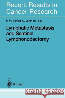 Lymphatic Metastasis and Sentinel Lymphonodectomy P. M. Schlag Umberto Veronesi 9783642630705