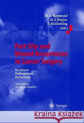 Port-Site and Wound Recurrences in Cancer Surgery: Incidence - Pathogenesis - Prevention Reymond, M. a. 9783642631177 Springer