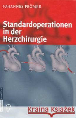 Standardoperationen in Der Herzchirurgie Frömke, Johannes 9783642632471 Steinkopff-Verlag Darmstadt