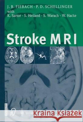 Stroke MRI Jochen Fiebach Peter Schellinger 9783642632532