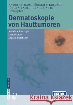 Dermatoskopie Von Hauttumoren: Auflichtmikroskopie -- Dermoskopie -- Digitale Bildanalyse Blum, A. 9783642632686 Steinkopff-Verlag Darmstadt