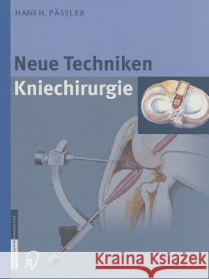 Neue Techniken Kniechirurgie H. H. Passler H. Thermann 9783642632839 Steinkopff-Verlag Darmstadt