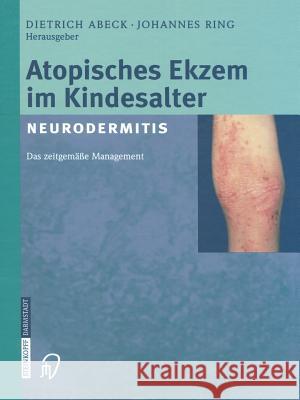 Atopisches Ekzem Im Kindesalter (Neurodermitis): Zeitgemäßes Management Abeck, D. 9783642632945