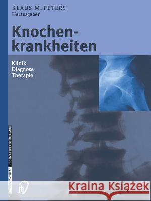 Knochenkrankheiten: Klinik Diagnose Therapie Eysel, P. 9783642632976 Steinkopff-Verlag Darmstadt