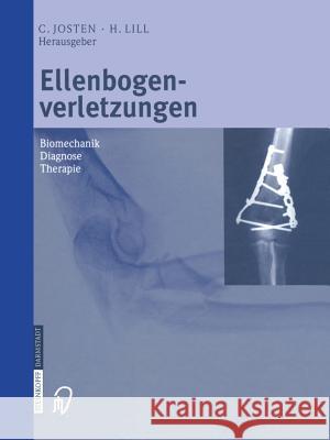 Ellenbogenverletzungen: Biomechanik ■ Diagnose ■ Therapie Josten, C. 9783642633119 Steinkopff-Verlag Darmstadt