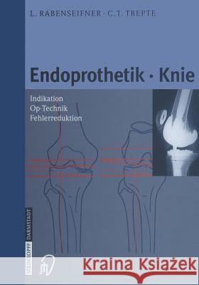 Endoprothetik Knie L. Rabenseifner C. Trepte 9783642633133 Steinkopff-Verlag Darmstadt
