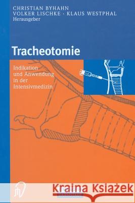 Tracheotomie: Indikation Und Anwendung in Der Intensivmedizin Byhahn, C. 9783642633287 Steinkopff-Verlag Darmstadt