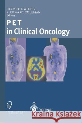 Pet in Clinical Oncology Wieler, Helmut J. 9783642633294 Steinkopff-Verlag Darmstadt