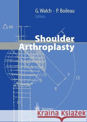 Shoulder Arthroplasty Gilles Walch Pascal Boileau N. Gschwend 9783642635540 Springer