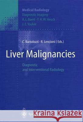 Liver Malignancies: Diagnostic and Interventional Radiology Baert, A. L. 9783642636790