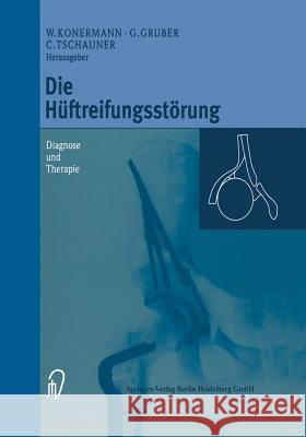 Die Hüftreifungsstörung: Diagnose Und Therapie Konermann, Werner 9783642636875 Steinkopff-Verlag Darmstadt