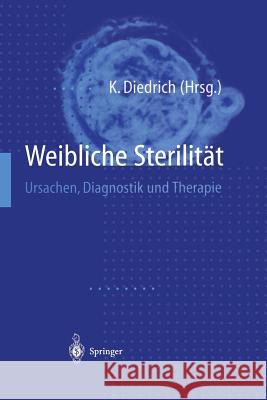 Weibliche Sterilität: Ursachen, Diagnostik Und Therapie Diedrich, Klaus 9783642637049 Springer