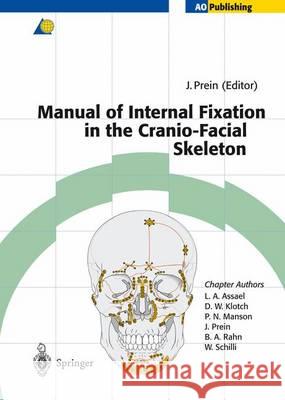 Manual of Internal Fixation in the Cranio-Facial Skeleton: Techniques Recommended by the Ao/Asif Maxillofacial Group Prein, Joachim 9783642637322 Springer