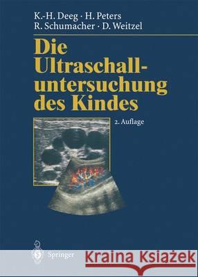 Die Ultraschalluntersuchung Des Kindes Deeg, Karl-Heinz 9783642638657