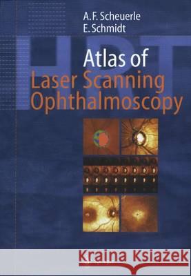 Atlas of Laser Scanning Ophthalmoscopy Alexander Friedrich Scheuerle H. E. Volcker L. E. Pillunat 9783642639210 Springer