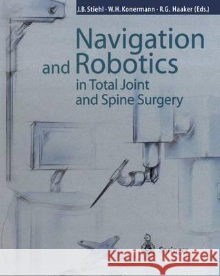 Navigation and Robotics in Total Joint and Spine Surgery James B. Stiehl Werner H. Konermann Rolf G. Haaker 9783642639227 Springer