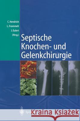 Septische Knochen-Und Gelenkchirurgie Christian Hendrich Lars Frommelt Jochen Eulert 9783642639289 Springer