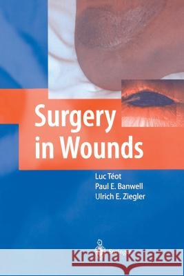 Surgery in Wounds Luc Teot Paul E. Banwell Ulrich E. Ziegler 9783642639296
